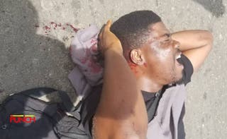 Tears! PUNCH Journalist<br>Battles With Life After Gun Attack From Lagos Police Officers During October 1 Protest