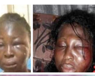 19 years old girl brutalised by her boyfriend in Delta State.