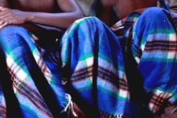 Mass circumcision claims lives of 39 men, dozens maimed in incompetent procedures