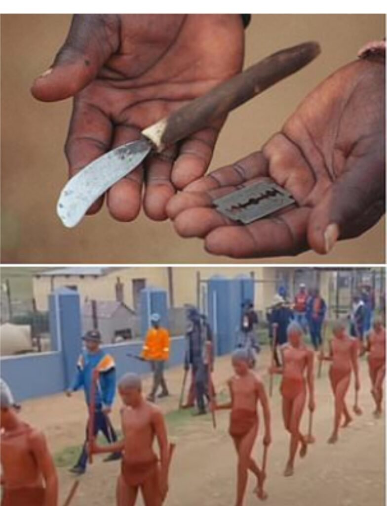 Victims of unskilled mass circumcision in South Africa.