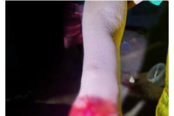 BREAKING NEWS: Man stabs Cousin over alleged affair with wife