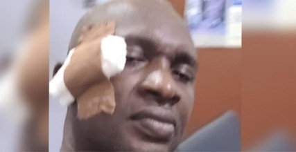 House member, Hon. Akachukwu Ucheonye contorting in pain from the attack by the majority leader of Abia State House of Assembly, Hon. Okoro Uchenna Kalu.