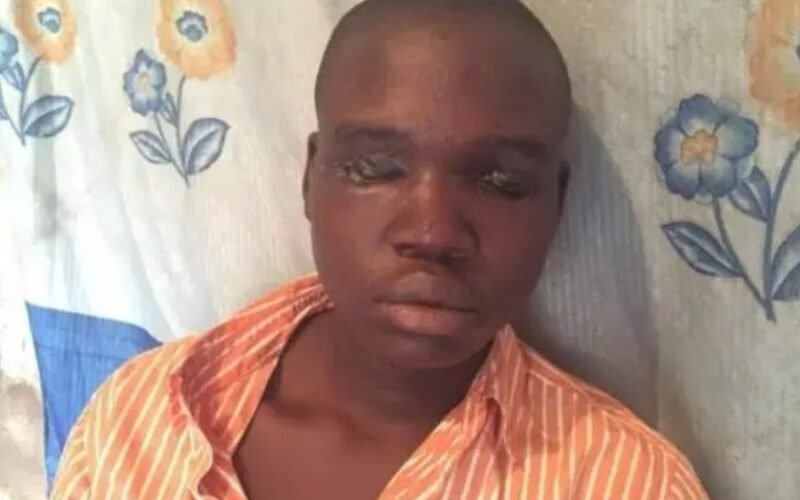 Shock in Community as Man Is Caught Attempting to Use Father for Ritual—