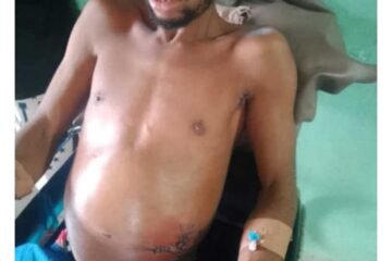 Commotion in Abia as Man Allegedly Stabs Only Son to Death Over Palm Fruit