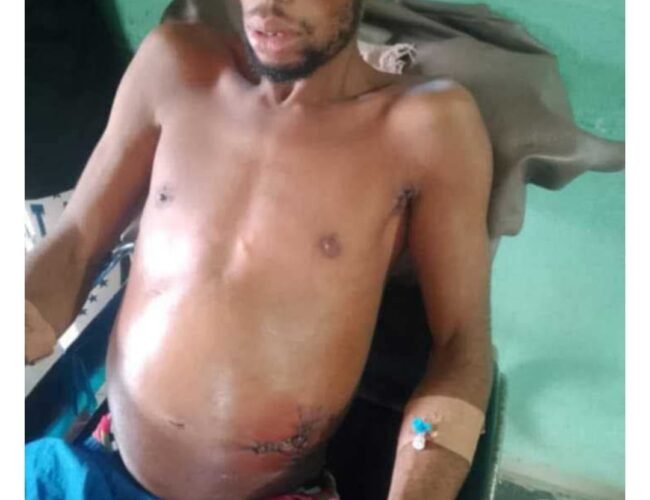 Commotion in Abia as Man Allegedly Stabs Only Son to Death Over Palm Fruit